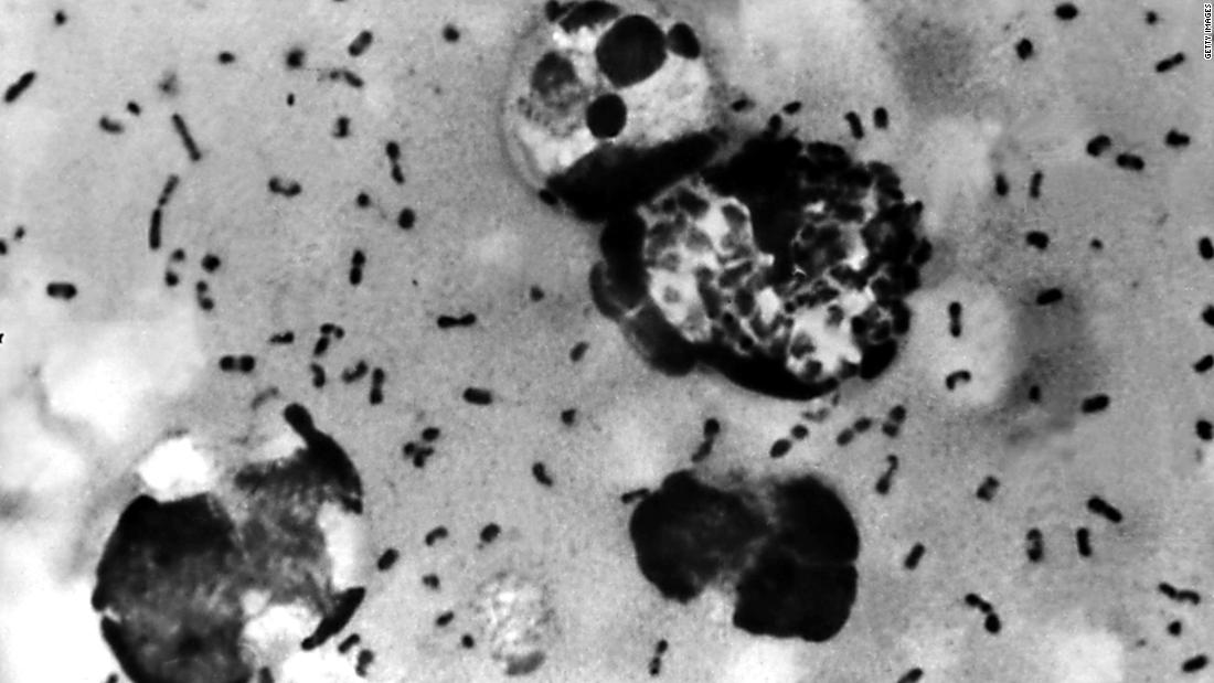 Bubonic plague: China closes tourist spots in Inner Mongolia after confirmed case