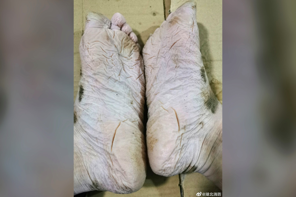 Overworked firefighter's disgusting feet go viral online