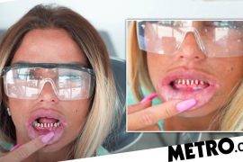 Katie Price 'panicked' as her teeth fell out before the holidays with her boyfriend