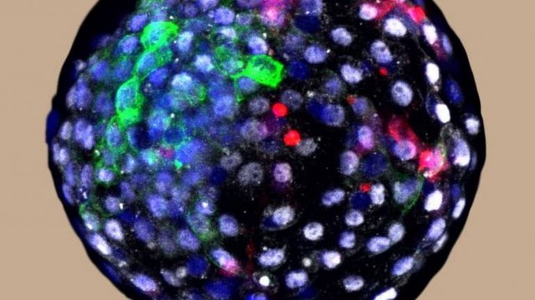 Controversial experiment with human cells growing in monkey embryos |  Science and Health