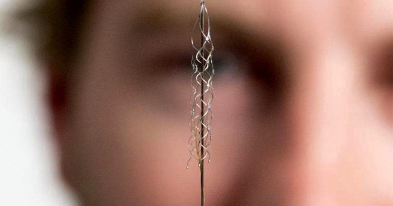 First, a chip attached to the brain allows a paralyzed person to tweet  Technology
