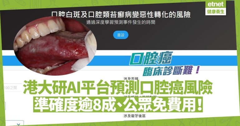 The clinical diagnosis of oral cancer is difficult!  Hong Kong University Research AI Platform Predicts Cancer Risk With 80% Accuracy!  Free Health-ET Net Mobile for Public Health, Good Life-Health and Good Life