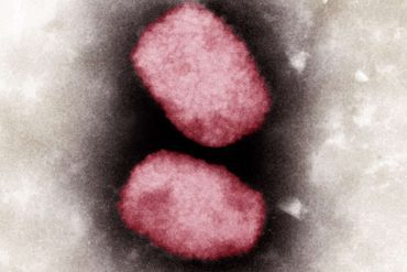 Eine Elektronenmikroskopische Aufnahme von Affenpocken-Viren. Foto: Andrea Männel/Andrea Schnartendorff/RKI/dpa