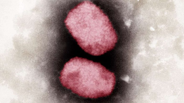 Eine Elektronenmikroskopische Aufnahme von Affenpocken-Viren. Foto: Andrea Männel/Andrea Schnartendorff/RKI/dpa