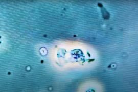 Is it scary?  A teenager killed in America has a 'brain-eating' amoeba