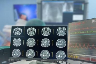 3 new brain tumor subtypes discovered